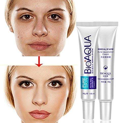 BIOAQUA Anti Acne Scar Mark Remover Removal Oil Control Shrink Pores Treatment Cream 30g 