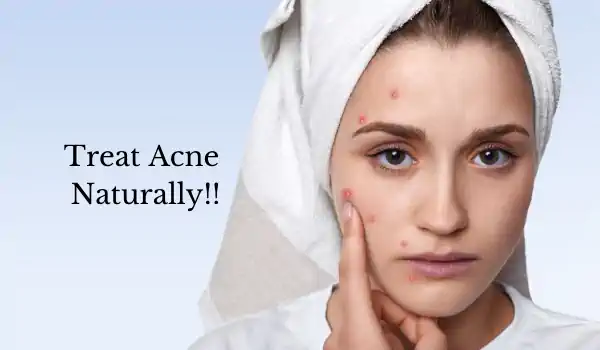2 - How to treat acne naturally at home?
