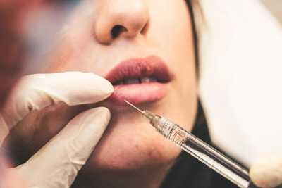 123 1 400x267 - Cosmetic Lip Fillers Are In Fashion